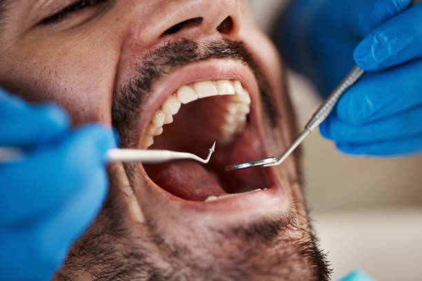 Oral Cancer Screening in Coon Rapids, MN